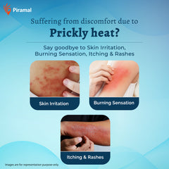 Tetmosol Prickly Heat Powder | Instant cooling - kills germs & leaves a refreshing fragrance