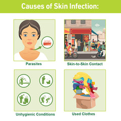 Cuases Of Skin Infection Image