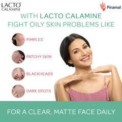 Lacto Calamine Face Lotion | Daily Moisturizer For Face - Combination To Normal Skin | Kaolin Clay & Aloe Vera | Fights Pimples, Darkspots & Blackheads | Body Lotion | 120ml