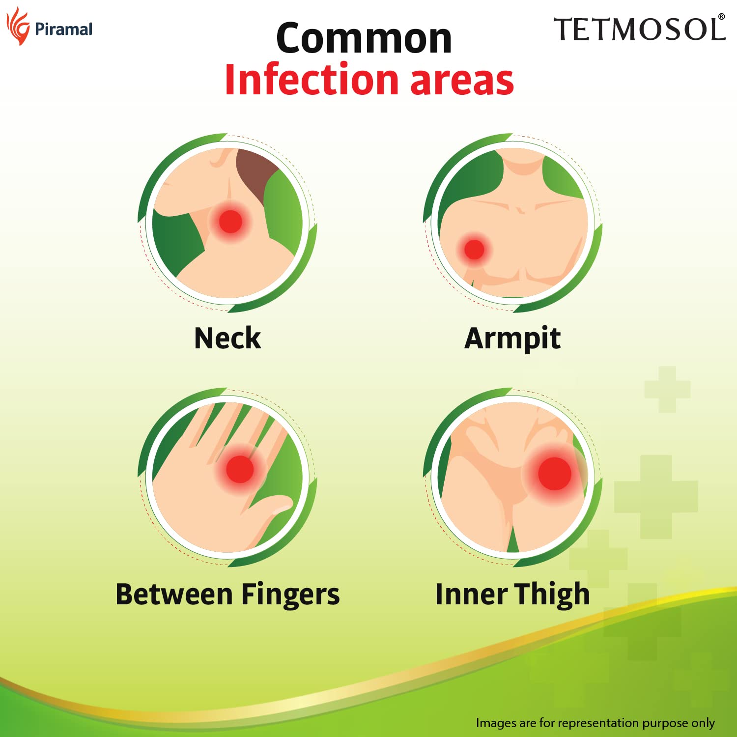 Tetmosol plus cream application