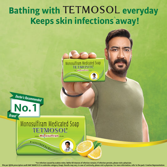 Tetmosol Monosulfiram Medicated Soap | Fights Skin Infections-100gm